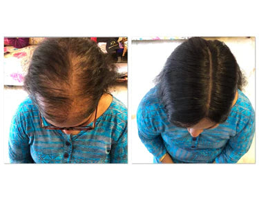 Lace Base Faux Scalp™ – Hair Topper