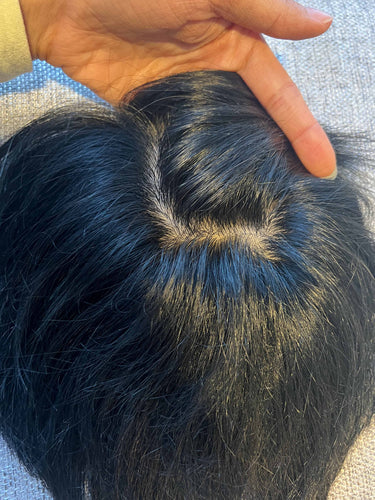 Men's Hair Patch